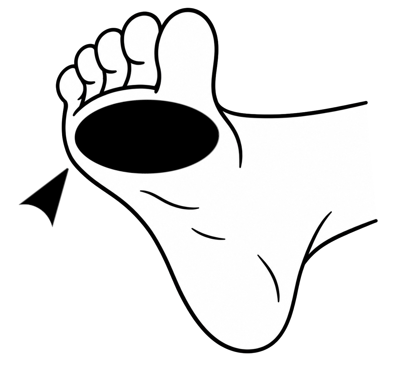 Koshi technique